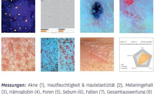 Digitale Hautanalyse im Kosmetikstudio Sendling